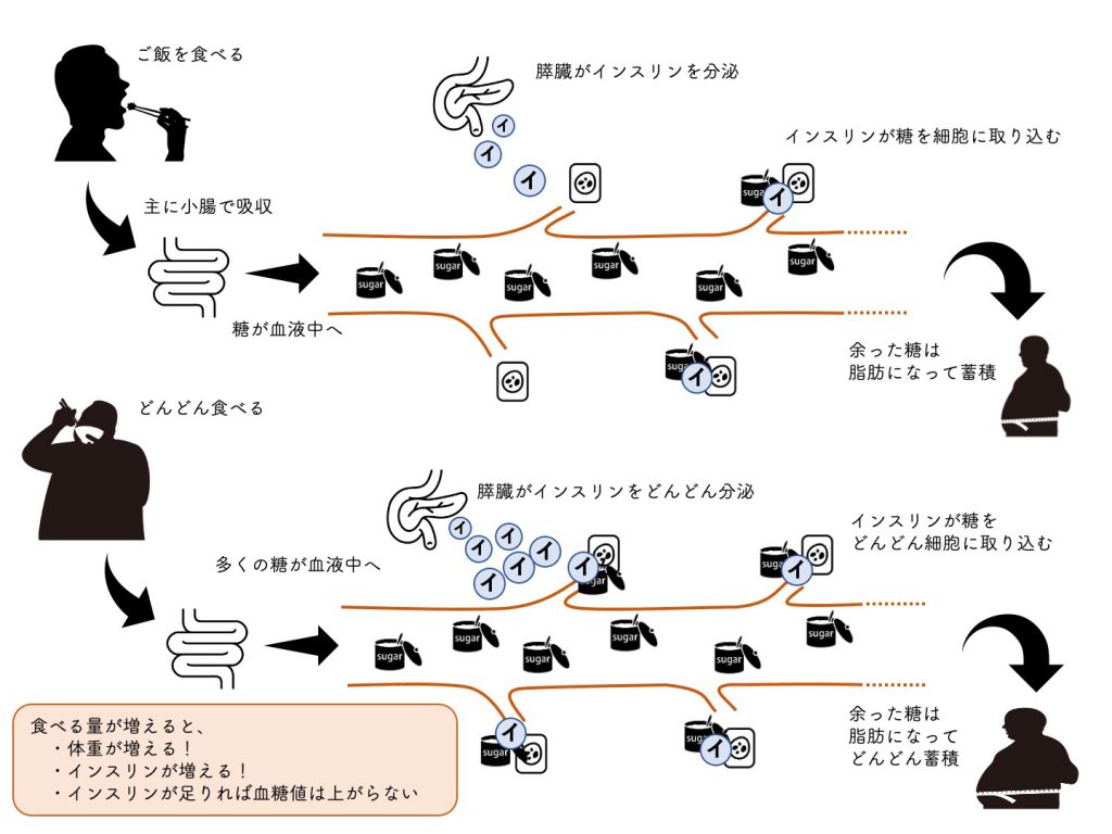 二 型 糖尿病